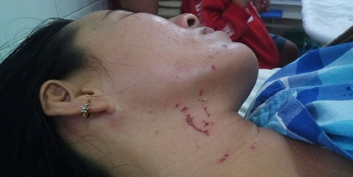 Vụ chồng đánh đập vợ từ dưới nước lên tận bờ ở Tây Ninh: Lời kể cay đắng của người vợ
