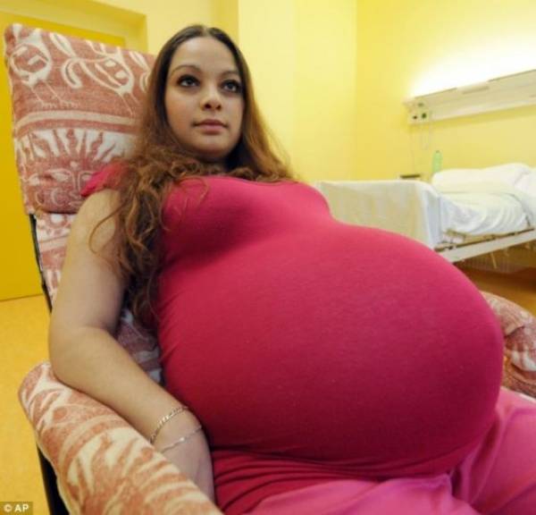 Mẹ trẻ 23 tuổi bầu quá to nghĩ mình mang thai đôi, khi đi khám phát hiện ‘kỳ tích’ 48 năm mới xuất hiện 1 lần