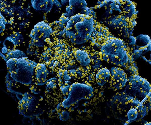 Trung Quốc tìm thấy kháng thể mới chống virus corona