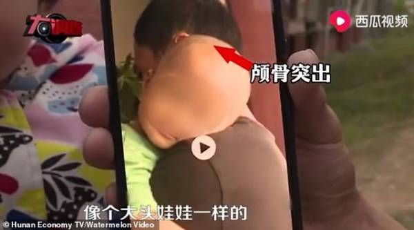 Trung Quốc điều tra nghi vấn sữa giả làm trẻ sơ sinh to đầu