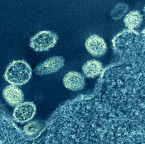 Chủng virus cúm mới được phát hiện ở Trung Quốc có nguy hiểm?