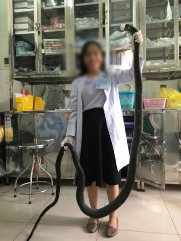 Thông tin bất ngờ vụ nhập viện cùng rắn hổ mang chúa 4,6 kg ở núi Bà Đen