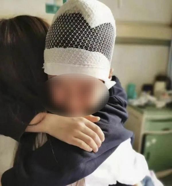 Trung Quốc bắt giữ giáo viên giật tóc làm chấn thương hộp sọ học sinh