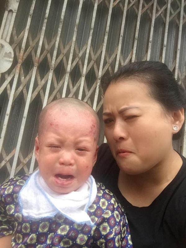 Nhật ký người mẹ nuôi của bé trai bị bỏ rơi: Nắng nóng, con ăn sữa lẫn máu
