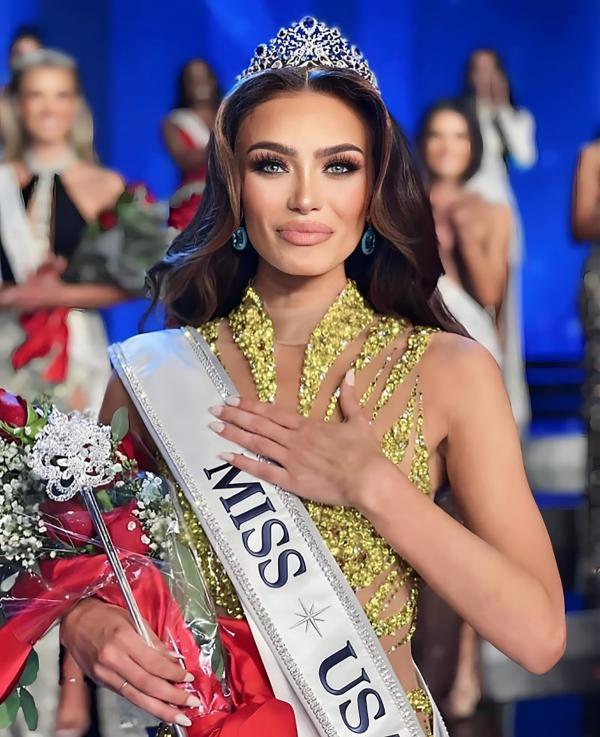 Nhan sắc người đẹp gốc Venezuela đăng quang Hoa hậu Mỹ
