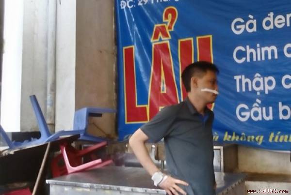 Hà Nội: Một gia đình bị côn đồ tấn công, cụ ông t‌ử von‌g