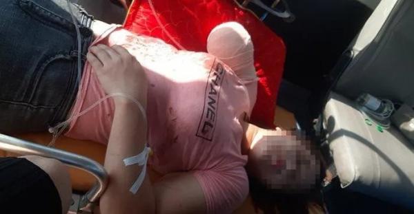 Gia cảnh đáng thương của người phụ nữ bị đứt lìa cánh tay trong vụ lật xe chở 21 công nhân ở Bắc Giang