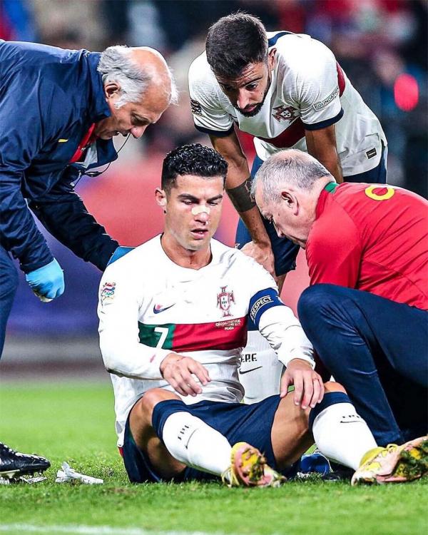 Hậu vỡ mũi, Ronaldo bất ngờ có “vũ khí bí mật” trước trận derby Manchester