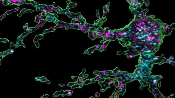Phát hiện tế bào giúp hình thành não trẻ nhỏ