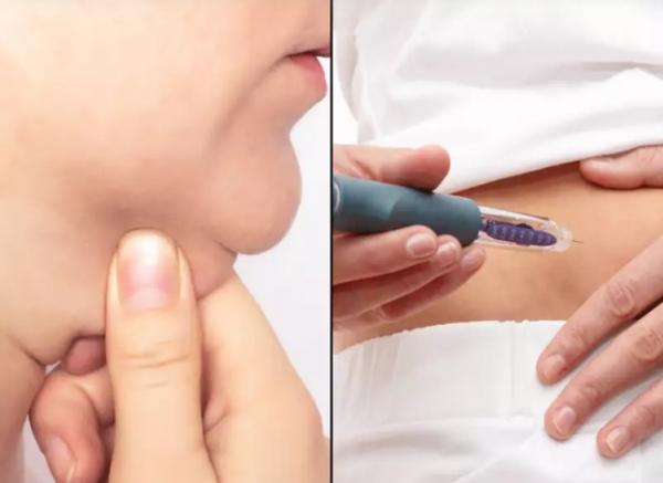 Tác dụng phụ của thuốc giảm cân được quảng cáo rầm rộ: “Con dao hai lưỡi” gây chảy sệ da cùng loạt bệnh tiềm ẩn