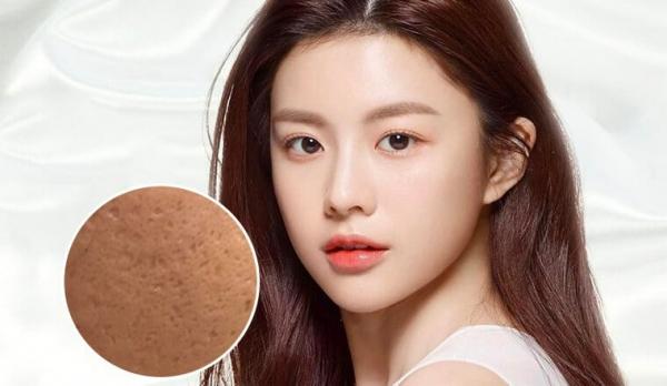 Mẹo xử lý sẹo rỗ phục hồi làn da căng mịn, giúp da sạch và sáng khỏe