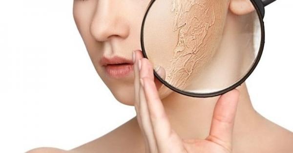 Bí quyết chăm sóc làn da khô sần, bong tróc trong mùa lạnh