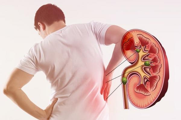 3 dấu hiệu rõ nhất của bệnh suy thận, số 1 chứng tỏ bệnh đã chuyển nặng